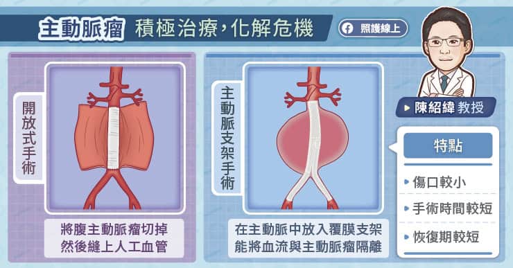 主動脈瘤積極治療