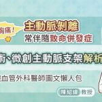 猛爆性胸痛！主動脈剝離常伴隨致命併發症，外科手術、微創主動脈支架解析，心臟血管外科醫師圖文懶人包