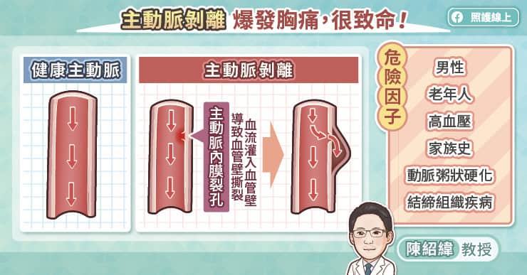 主動脈剝離爆發胸痛