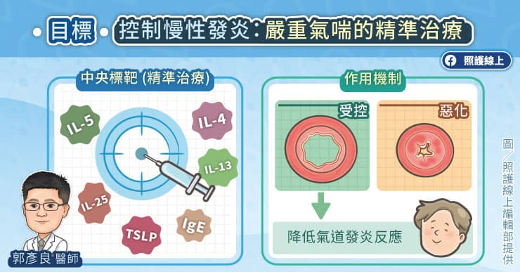 控制慢性發炎，嚴重氣喘的精準治療