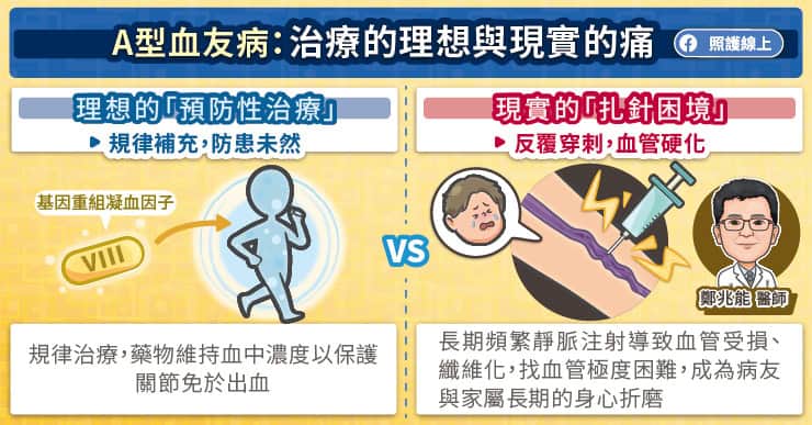 A型血友病治療的理想與現實的痛