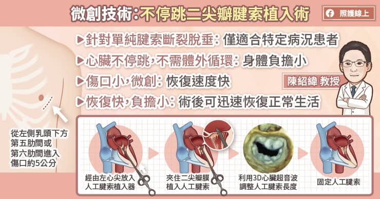 不停跳二尖瓣腱索植入修補手術