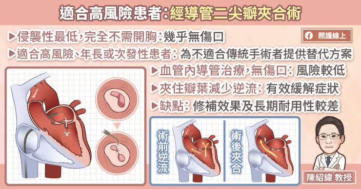 經導管二尖瓣夾合術(適合高風險患者)