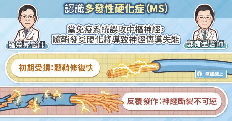 多發性硬化症