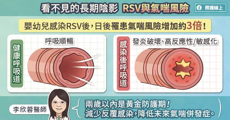 RSV未來罹患氣喘的風險