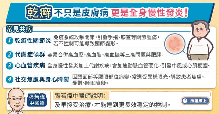 乾癬不只是皮膚病更是全身慢性發炎