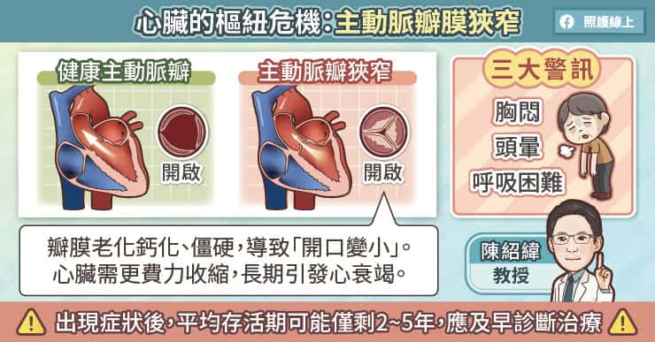 主動脈瓣狹窄