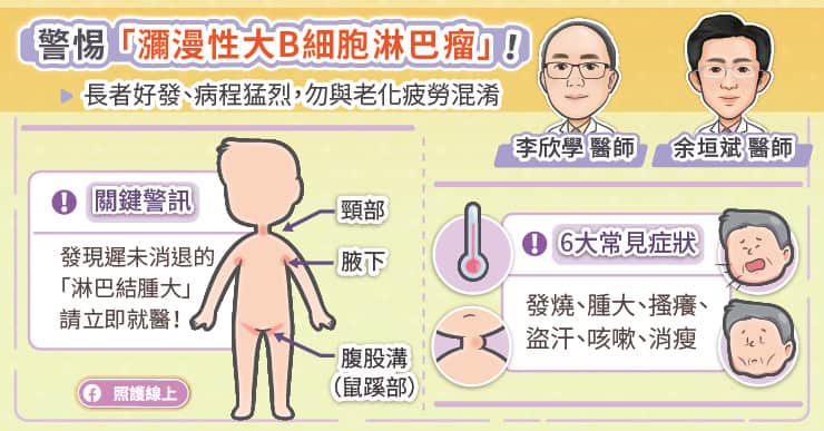 警惕瀰漫性大B細胞淋巴瘤
