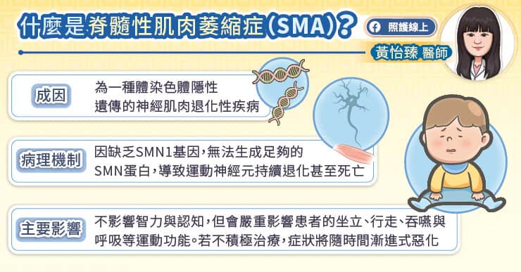 什麼是脊髓性肌肉萎縮症(SMA)
