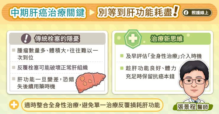 中期肝癌治療關鍵