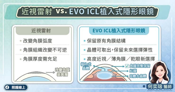 近視雷射與EVO ICL 植入式隱形眼鏡